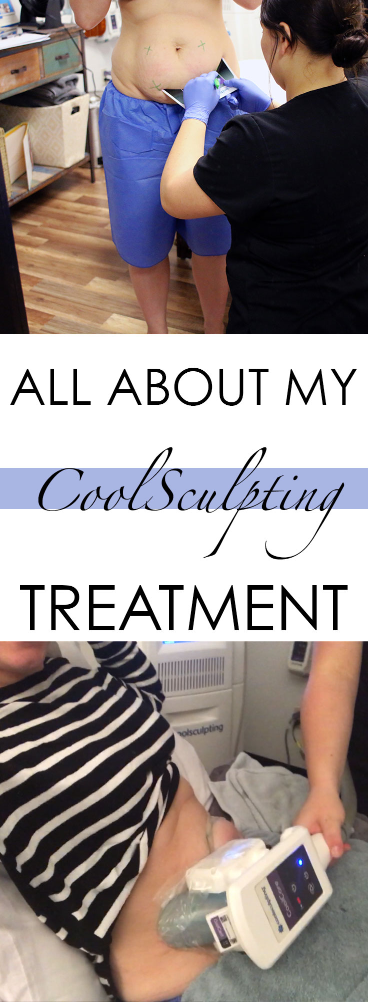 Complimentary Coolsculpting Consultation Day November 19: Holly